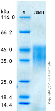 SDS-PAGE - Recombinant Human TREM-1 Protein Standard (His tag) (AB316599)