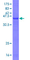 SDS-PAGE - Recombinant Human TREM1 protein (AB132233), expandable thumbnail