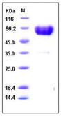 SDS-PAGE - Recombinant Human TREM1 protein (Fc Chimera His Tag) (AB276285), expandable thumbnail
