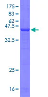 SDS-PAGE - Recombinant Human TREM1 protein (GST tag N-Terminus) (AB132233)