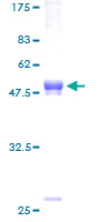 Recombinant Human TREM2 protein