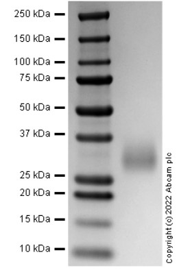 SDS-PAGE - Recombinant Human TREM2 protein (AB290831)