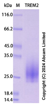 SDS-PAGE - Recombinant Human TREM2 Protein Standard (His tag) (AB322291), expandable thumbnail