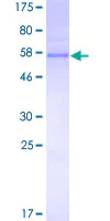 SDS-PAGE - Recombinant Human TREX1 protein (AB161394)