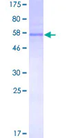 SDS-PAGE - Recombinant Human TREX1 protein (GST tag N-Terminus) (AB161394)