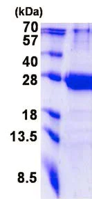 SDS-PAGE - Recombinant Human TRFP/MED20 protein (His tag N-Terminus) (AB139245)