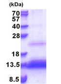 SDS-PAGE - Recombinant Human TRIAP1 protein (His tag N-Terminus) (AB176057)