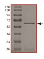 SDS-PAGE - Recombinant Human TRIB2 protein (AB186094), expandable thumbnail