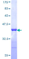 SDS-PAGE - Recombinant Human TRIM21/SS-A protein (Tagged) (AB114611)
