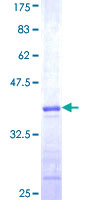 Recombinant Human TRIM68 protein