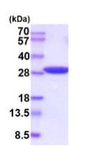 SDS-PAGE - Recombinant human Triosephosphate isomerase protein (Active) (His tag N-Terminus) (AB224782)