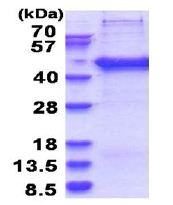 Recombinant Human TRIP-Br2 protein