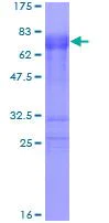 SDS-PAGE - Recombinant Human Tristetraprolin/TTP protein (AB112374)