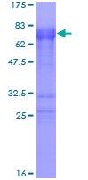 SDS-PAGE - Recombinant Human Tristetraprolin/TTP protein (AB112374)