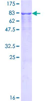 SDS-PAGE - Recombinant Human TRK fused gene protein (AB153070)