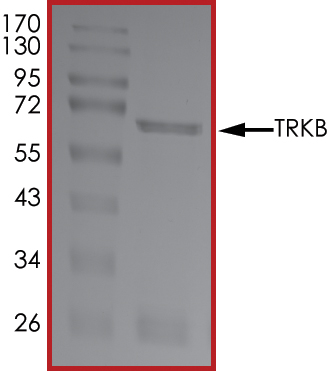 Recombinant human TrkB protein