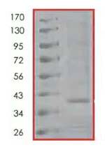 SDS-PAGE - Recombinant human TrkC protein (AB85274)