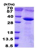 SDS-PAGE - Recombinant Human TROP2 protein (denatured) (AB139796)