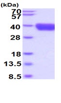 SDS-PAGE - Recombinant Human TROP2 protein (His tag C-Terminus) (AB219424)