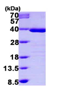 SDS-PAGE - Recombinant Human Tropomyosin 1 (alpha) protein (His tag N-Terminus) (AB99214)