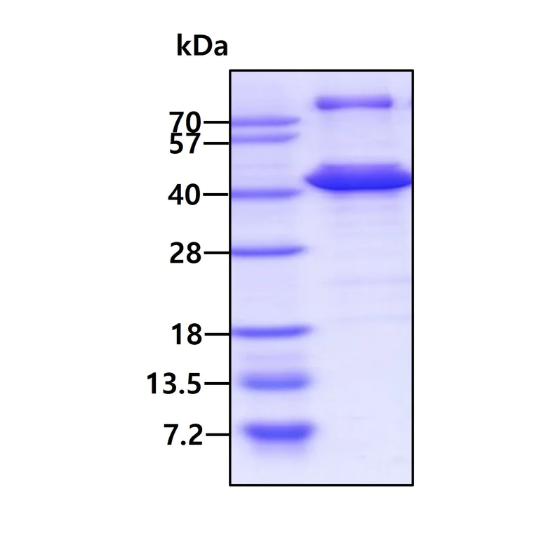 SDS-PAGE - Recombinant Human Tropomyosin 2 protein (AB103503)