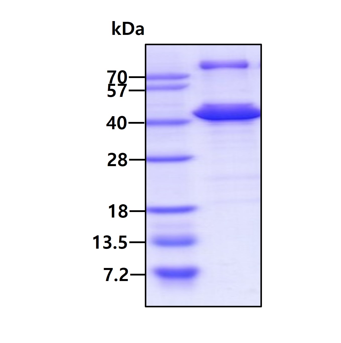 SDS-PAGE - Recombinant Human Tropomyosin 2 protein (His tag N-Terminus) (AB103503)