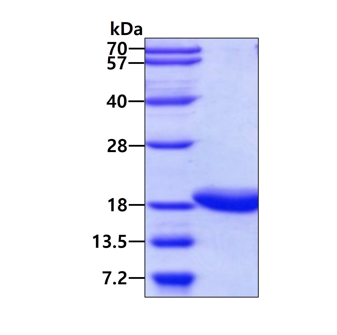 SDS-PAGE - Recombinant Human Troponin C protein (Tag Free) (AB86690)