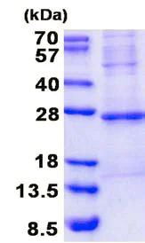 SDS-PAGE - Recombinant Human Troponin I fast skeletal muscle protein (denatured) (AB137152)