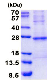 SDS-PAGE - Recombinant Human Troponin I fast skeletal muscle protein (denatured) (His tag N-Terminus) (AB137152)