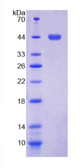 SDS-PAGE - Recombinant Human TROVE2/SS-A protein (Tagged) (AB275560), expandable thumbnail