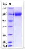 SDS-PAGE - Recombinant Human TRP1 protein (His tag) (AB276513)