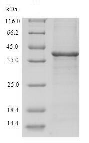 SDS-PAGE - Recombinant Human TRP14 protein (Tagged) (AB236190), expandable thumbnail