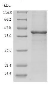 SDS-PAGE - Recombinant Human TRP14 protein (Tagged) (AB236190)