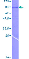 SDS-PAGE - Recombinant Human TRP2/DCT protein (AB158267), expandable thumbnail