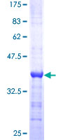 SDS-PAGE - Recombinant Human TRP2/DCT protein (AB158268), expandable thumbnail