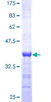 SDS-PAGE - Recombinant Human TRP2/DCT protein (GST tag N-Terminus) (AB158268)