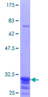 SDS-PAGE - Recombinant Human TRPC6 protein (AB152771)