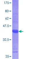 SDS-PAGE - Recombinant Human TRPM7 protein (GST tag N-Terminus) (AB153385)