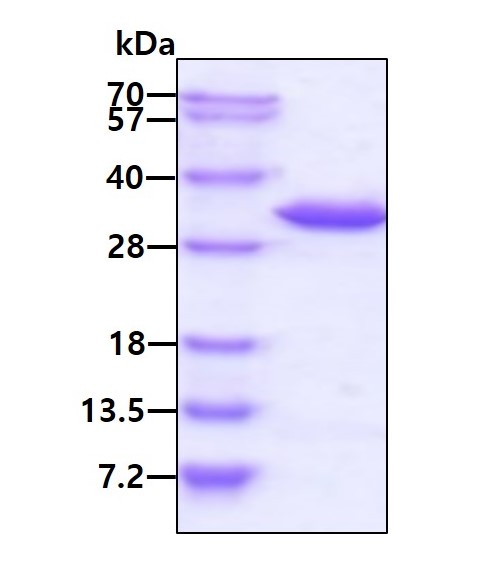 SDS-PAGE - Recombinant Human TRPT1 protein (AB116176), expandable thumbnail