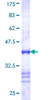 SDS-PAGE - Recombinant Human TRPV5 protein (AB153420)