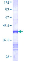 SDS-PAGE - Recombinant Human TRPV5 protein (AB153420)