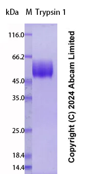 SDS-PAGE - Recombinant Human Trypsin 1 Protein Standard (His tag) (AB323027)