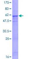 SDS-PAGE - Recombinant Human TSG6 protein (GST tag N-Terminus) (AB132329)