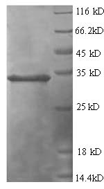 SDS-PAGE - Recombinant Human TSG6 protein (His tag) (AB236337)