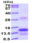 Western blot - Recombinant Human TSH beta protein (denatured) (His tag N-Terminus) (AB176027)