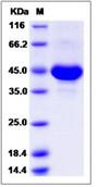 SDS-PAGE - Recombinant Human Tspan-8 protein (Fc Chimera) (AB276679), expandable thumbnail