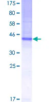 SDS-PAGE - Recombinant Human Tspan-8 protein (GST tag N-Terminus) (AB159720)