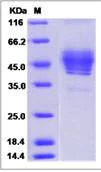 SDS-PAGE - Recombinant Human TSPAN1 protein (Fc Chimera) (AB276497)