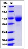 SDS-PAGE - Recombinant Human TSPAN31 protein (Fc Chimera) (AB276615)