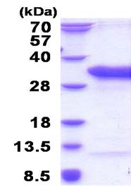 SDS-PAGE - Recombinant Human TSR2 protein (AB183259)